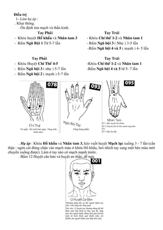 Điều trị
1- Làm hạ áp :
. Khai thông.
. Ổn định tim mạch và thần kinh.
Tay Phaûi Tay Traùi
- Khoùa huyeät Hoå khaåu vaø Nhaân tam 3 - Khoùa Chí theá 1-2 vaø Nhaân tam 1
- Baám Nguõ Boäi 1 Töø 5-7 laàn - Baám Nguõ boäi 3 ( Nheï ) 3-5 laàn
-Baám Nguõ boäi 4 vaø 5 ( maïnh ) 4- 5 laàn
Tay Phaûi Tay Traùi
- Khoùa Huyeät Chí Theá 4-5 -Khoùa Chí theá 1-2 vaø Nhaân tam 1
- Baám Nguõ boäi 3 ( nheï ) 5-7 laàn -Baám Nguõ boäi 4 vaø 5 töø 5- 7 laàn
- Baám Nguõ boäi 2 ( maïnh ) 5-7 laàn
. Hạ áp : Khóa Hổ khẩu và Nhân tam 3, kéo vuốt huyệt Mạch lạc xuống 3 - 7 lần (cẩn
thận : ngón cái đừng chận vào mạch máu ở khóa Hổ khẩu, hơi nhích tay sang một bên máu mới
chuyển xuống được). Làm ở tay nào có mạch mạnh trước.
. Bấm 12 Huyệt căn bản và huyệt an thần, dễ ngủ.
 