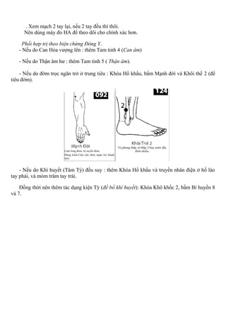 . Xem mạch 2 tay lại, nếu 2 tay đều thì thôi.
Nên dùng máy đo HA để theo dõi cho chính xác hơn.
Phối hợp trị theo biện chứng Đông Y.
- Nếu do Can Hỏa vượng lên : thêm Tam tinh 4 (Can âm)
- Nếu do Thận âm hư : thêm Tam tinh 5 ( Thận âm).
- Nếu do đờm trọc ngăn trở ở trung tiêu : Khóa Hổ khẩu, bấm Mạnh đới và Khôi thế 2 (để
tiêu đờm).
- Nếu do Khí huyết (Tâm Tỳ) đều suy : thêm Khóa Hổ khẩu và truyền nhân điện ở hố lào
tay phải, và mỏm trâm tay trái.
Đồng thời nên thêm tác dụng kiện Tỳ (để bổ khí huyết): Khóa Khô khốc 2, bấm Bí huyền 8
và 7.
 