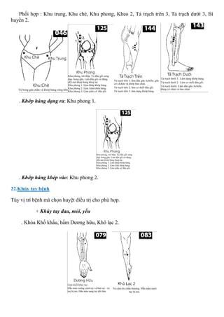 Phối hợp : Khu trung, Khu chè, Khu phong, Kheo 2, Tả trạch trên 3, Tả trạch dưới 3, Bí
huyền 2.
. Khớp háng dạng ra: Khu phong 1.
. Khớp háng khép vào: Khu phong 2.
22.Khủy tay bệnh
Tùy vị trí bệnh mà chọn huyệt điều trị cho phù hợp.
+ Khủy tay đau, mỏi, yếu
. Khóa Khổ khẩu, bấm Dương hữu, Khô lạc 2.
 