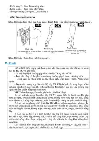 . Khóa lóng 2 + bấm theo đường kinh.
. Khóa lóng 3 + bấm vùng khuỷu tay.
. Khóa gốc móng (trừ ngón 3), day khớp 2.
+ Khủy tay co gấp vào ngực
Khóa Hổ khẩu, bấm Khôi lâu, Khư trung, Trạch đoán (vừa bấm vừa nhẹ đẩy cánh tay ra).
Khóa Hổ khẩu + bấm Tam tinh (trừ ngón 3).
23.Liệt mặt
Liệt mặt là hiện tượng mất hoặc giảm vận động nửa mặt của những cơ da ở
mặt do dây TK VII chi phối.
- Là một loại bịnh thường gặp nhất của dây TK sọ não số VII.
- Tuổi nào cũng có thể phát bịnh nhưng thường gặp ở thanh và tráng niên.
- Đông ygọi là Khẩu nhãn oa tà, Khẩu tịch, Diện nan (Than), Phong điếu
tuyến.
- Đa số các trường hợp liệt mặt (liệt dây TK VII) do lạnh, do xung huyết, điều
trị bằng bấm huyệt ngay sau khi bị bệnh thường đem lại kết quả tốt. Các trường hợp
liệt do nhiễm khuẩn hồi phục chậm hơn.
YHCT dựa theo nguyên nhân gây bịnh, chia làm 3 loại:
1- Liệt mặt do phong hàn (liệt dây TK VII ngoại biên do lạnh): sau khi gặp
mưa gió lạnh, tự nhiên mắt không nhắm được, miệng méo cùng bên với mắt, uống
nước bị trào ra, không huýt sáo được, toàn thân có hiện tượng sợ lạnh, rêu lưỡi trắng.
2- Liệt mặt do phong nhiệt (liệt dây TK VII ngoại biên do nhiễm khuẩn): Tự
nhiên mắt không nhắm được, miệng méo cùng bên với mắt, ăn uống nhai khó, uống
nước thường bị trào ra, không huýt sáo được, toàn thân có sốt, sợ gió, rêu lưỡi trắng
dầy.
3- Liệt mặt do huyết ứ ở kinh lạc (liệt dây TK VII ngoại biên do sang chẩn):
Sau khi té ngã, đánh đập, thương tích, sau khi mổ vùng hàm, mặt, xương chũm... tự
nhiên mắt không nhắm được, miệng méo cùng bên với mắt, ăn uống khó, không huýt
sáo được.
Đối với môn bấm Thập chỉ đạo, thường là điều trị di chứng, vì vậy, tùy theo vị
trí méo lệch mà chọn huyệt và vị trí điều trị cho thích hợp.
 