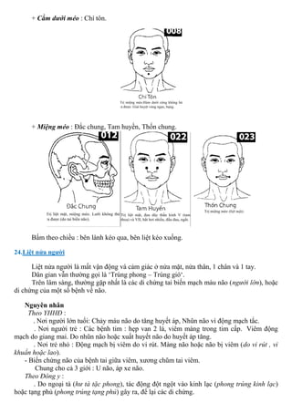 + Cằm dưới méo : Chí tôn.
+ Miệng méo : Đắc chung, Tam huyền, Thốn chung.
Bấm theo chiều : bên lành kéo qua, bên liệt kéo xuống.
24.Liệt nửa người
Liệt nửa người là mất vận động và cảm giác ở nửa mặt, nửa thân, 1 chân và 1 tay.
Dân gian vẫn thường gọi là ‘Trúng phong – Trúng gió‘.
Trên lâm sàng, thường gặp nhất là các di chứng tai biến mạch máu não (người lớn), hoặc
di chứng của một số bệnh về não.
Nguyên nhân
Theo YHHĐ :
. Nơi người lớn tuổi: Chảy máu não do tăng huyết áp, Nhũn não vì động mạch tắc.
. Nơi người trẻ : Các bệnh tim : hẹp van 2 lá, viêm màng trong tim cấp. Viêm động
mạch do giang mai. Do nhũn não hoặc xuất huyết não do huyết áp tăng.
. Nơi trẻ nhỏ : Động mạch bị viêm do vi rút. Màng não hoặc não bị viêm (do vi rút , vi
khuẩn hoặc lao).
- Biến chứng não của bệnh tai giữa viêm, xương chũm tai viêm.
Chung cho cả 3 giới : U não, áp xe não.
Theo Đông y :
. Do ngoại tà (hư tà tặc phong), tác động đột ngột vào kinh lạc (phong trúng kinh lạc)
hoặc tạng phủ (phong trúng tạng phủ) gây ra, để lại các di chứng.
 
