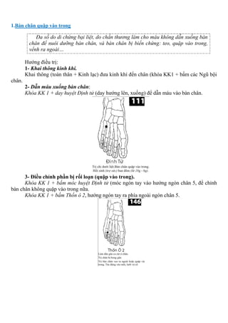 1.Bàn chân quặp vào trong
Đa số do di chứng bại liệt, do chấn thương làm cho máu không dẫn xuống bàn
chân để nuôi dưỡng bàn chân, và bàn chân bị biến chứng: teo, quặp vào trong,
vểnh ra ngoài…
Hướng điều trị:
1- Khai thông kinh khí.
Khai thông (toàn thân + Kinh lạc) đưa kinh khí đến chân (khóa KK1 + bấm các Ngũ bội
chân.
2- Dẫn máu xuống bàn chân:
Khóa KK 1 + day huyệt Định tử (day hướng lên, xuống) để dẫn máu vào bàn chân.
3- Điều chỉnh phần bị rối loạn (quặp vào trong).
Khóa KK 1 + bấm móc huyệt Định tử (móc ngón tay vào hướng ngón chân 5, để chỉnh
bàn chân không quặp vào trong nữa.
Khóa KK 1 + bấm Thốn ô 2, hướng ngón tay ra phía ngoài ngón chân 5.
 