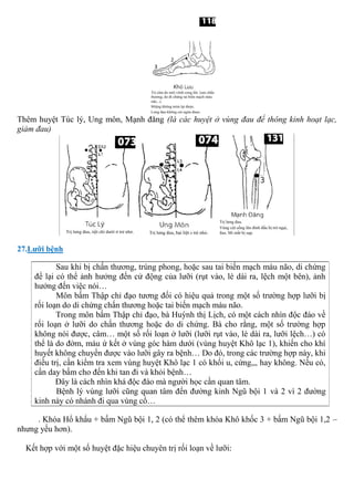 Thêm huyệt Túc lý, Ung môn, Mạnh đăng (là các huyệt ở vùng đau để thông kinh hoạt lạc,
giảm đau)
27.Lưỡi bệnh
Sau khi bị chấn thương, trúng phong, hoặc sau tai biến mạch máu não, di chứng
để lại có thể ảnh hưởng đến cử động của lưỡi (rụt vào, lè dài ra, lệch một bên), ảnh
hưởng đến việc nói…
Môn bấm Thập chỉ đạo tương đối có hiệu quả trong một số trường hợp lưỡi bị
rối loạn do di chứng chấn thương hoặc tai biến mạch máu não.
Trong môn bấm Thập chỉ đạo, bà Huỳnh thị Lịch, có một cách nhìn độc đáo về
rối loạn ở lưỡi do chấn thương hoặc do di chứng. Bà cho rằng, một số trường hợp
không nói được, câm… một số rối loạn ở lưỡi (lưỡi rụt vào, lè dài ra, lưỡi lệch…) có
thể là do đờm, máu ứ kết ở vùng góc hàm dưới (vùng huyệt Khô lạc 1), khiến cho khí
huyết không chuyển được vào lưỡi gây ra bệnh… Do đó, trong các trường hợp này, khi
điều trị, cần kiểm tra xem vùng huyệt Khô lạc 1 có khối u, cứng,,, hay không. Nếu có,
cần day bấm cho đến khi tan đi và khỏi bệnh…
Đây là cách nhìn khá độc đáo mà người học cần quan tâm.
Bệnh lý vùng lưỡi cũng quan tâm đến đường kinh Ngũ bội 1 và 2 vì 2 đường
kinh này có nhánh đi qua vùng cổ…
. Khóa Hổ khẩu + bấm Ngũ bội 1, 2 (có thể thêm khóa Khô khốc 3 + bấm Ngũ bội 1,2 –
nhưng yếu hơn).
Kết hợp với một số huyệt đặc hiệu chuyên trị rối loạn về lưỡi:
 