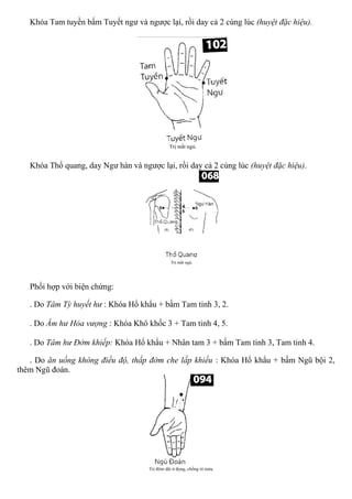 Khóa Tam tuyền bấm Tuyết ngư và ngược lại, rồi day cả 2 cùng lúc (huyệt đặc hiệu).
Khóa Thổ quang, day Ngư hàn và ngược lại, rồi day cả 2 cùng lúc (huyệt đặc hiệu).
Phối hợp với biện chứng:
. Do Tâm Tỳ huyết hư : Khóa Hổ khẩu + bấm Tam tinh 3, 2.
. Do Âm hư Hỏa vượng : Khóa Khô khốc 3 + Tam tinh 4, 5.
. Do Tâm hư Đởm khiếp: Khóa Hổ khẩu + Nhân tam 3 + bấm Tam tinh 3, Tam tinh 4.
. Do ăn uống không điều độ, thấp đờm che lấp khiếu : Khóa Hổ khẩu + bấm Ngũ bội 2,
thêm Ngũ đoán.
 