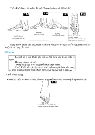 Thêm Khô thống, Kim nhũ, Tả nhũ, Thốn ô (thông kinh khí tại chỗ).
Dùng huyệt chính làm chủ, thêm các huyệt vùng cục bộ (gần chỗ bong gân) hoặc các
huyệt có tác dụng dẫn máu...
31.Mắt lác
Là một tật ở mắt khiến cho mắt có thể bị lé vào trong hoặc ra
ngoài.
Thường gặp nơi trẻ nhỏ.
. Dùng huyệt đặc hiệu: huyệt Đối nhãn (bên bệnh).
Huyệt Khô khốc giữa (tùy theo vị trí lệch ra ngoài hoặc vào trong
để chọn thủ pháp bấm), nhưng luôn theo chiều nghịch với vị trí bị lé.
+ Mắt lé vào trong:
. Khóa Khô khốc 3 + khóa Achile, bấm bật huyệt Đối nhãn vào mé trong  ngón chân cái.
 