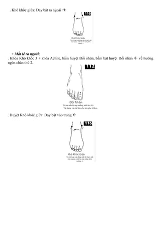 . Khô khốc giữa: Day bật ra ngoài 
+ Mắt lé ra ngoài:
. Khóa Khô khốc 3 + khóa Achile, bấm huyệt Đối nhãn, bấm bật huyệt Đối nhãn  về hướng
ngón chân thứ 2.
. Huyệt Khô khốc giữa: Day bật vào trong 
 