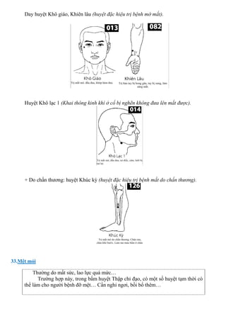 Day huyệt Khô giáo, Khiên lâu (huyệt đặc hiệu trị bệnh mờ mắt).
Huyệt Khô lạc 1 (Khai thông kinh khí ở cổ bị nghẽn không đưa lên mắt được).
+ Do chấn thương: huyệt Khúc kỳ (huyệt đặc hiệu trị bệnh mắt do chấn thương).
33.Mệt mỏi
Thường do mất sức, lao lực quá mức…
Trường hợp này, trong bấm huyệt Thập chỉ đạo, có một số huyệt tạm thời có
thể làm cho người bệnh đỡ mệt… Cần nghỉ ngơi, bồi bổ thêm…
 