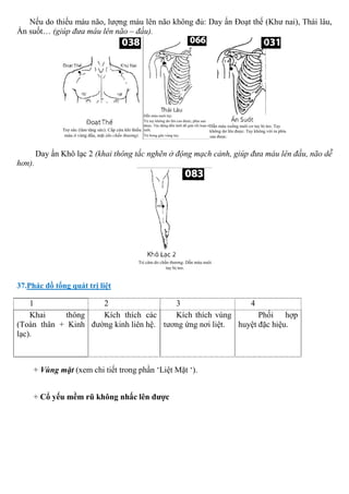 Nếu do thiếu máu não, lượng máu lên não không đủ: Day ấn Đoạt thế (Khư nai), Thái lâu,
Ấn suốt… (giúp đưa máu lên não – đầu).
Day ấn Khô lạc 2 (khai thông tắc nghẽn ở động mạch cảnh, giúp đưa máu lên đầu, não dễ
hơn).
37.Phác đồ tổng quát trị liệt
1 2 3 4
Khai thông
(Toàn thân + Kinh
lạc).
Kích thích các
đường kinh liên hệ.
Kích thích vùng
tương ứng nơi liệt.
Phối hợp
huyệt đặc hiệu.
+ Vùng mặt (xem chi tiết trong phần ‘Liệt Mặt ‘).
+ Cổ yếu mềm rũ không nhấc lên được
 