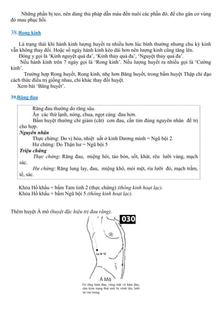 Những phần bị teo, nên dùng thủ pháp dẫn máu đến nuôi các phần đó, để cho gân cơ vùng
đó mau phục hồi.
38.Rong kinh
Là trạng thái khi hành kinh lượng huyết ra nhiều hơn lúc bình thường nhưng chu kỳ kinh
vẫn không thay đổi. Hoặc số ngày hành kinh kéo dài hơn nên lượng kinh cũng tăng lên.
Đông y gọi là ‘Kinh nguyệt quá đa’, ‘Kinh thủy quá đa’, ‘Nguyệt thủy quá đa’.
Nếu hành kinh trên 7 ngày gọi là ‘Rong kinh’. Nếu lượng huyết ra nhiều gọi là ‘Cường
kinh’.
Trường hợp Rong huyết, Rong kinh, nhẹ hơn Băng huyết, trong bấm huyệt Thập chỉ đạo
cách thức điều trị giống nhau, chỉ khác thay đổi huyệt.
Xem bài ‘Băng huyết’.
39.Răng đau
Răng đau thường do răng sâu.
Ăn các thứ lạnh, nóng, chua, ngọt càng đau hơn.
Bấm huyệt thường chỉ giảm (cắt) cơn đau, cần tìm đúng nguyên nhân để trị
cho hợp.
Nguyên nhân
Thực chứng: Do vị hỏa, nhiệt uất ở kinh Dương minh = Ngũ bội 2.
Hư chứng: Do Thận hư = Ngũ bội 5
Triệu chứng
Thực chứng: Răng đau, miệng hôi, táo bón, sốt, khát, rêu lưỡi vàng, mạch
sác.
Hư chứng: Răng lung lay, đau, miệng khô, mỏi mệt, rìa lưỡi đỏ, mạch trầm,
tế, sác.
Khóa Hổ khẩu + bấm Tam tinh 2 (thực chứng) (thông kinh hoạt lạc).
Khóa Hổ khẩu + bấm Ngũ bội 5 (thông kinh hoạt lạc).
Thêm huyệt Á mô (huyệt đặc hiệu trị đau răng).
 