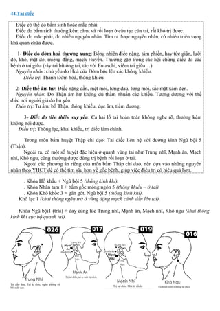 44.Tai điếc
Điếc có thể do bẩm sinh hoặc mắc phải.
Điếc do bẩm sinh thường kèm câm, và rối loạn ở cấu tạo của tai, rất khó trị được.
Điếc do mắc phải, do nhiều nguyên nhân. Tìm ra được nguyên nhân, có nhiều triển vọng
khả quan chữa được.
1- Điếc do đờm hoả thượng xung: Bỗng nhiên điếc nặng, tâm phiền, hay tức giận, lưỡi
đỏ, khô, mặt đỏ, miệng đắng, mạch Huyền. Thường gặp trong các hội chứng điếc do các
bệnh ở tai giữa (ráy tai bít ống tai, tắc vòi Eutaschi, viêm tai giữa…).
Nguyên nhân: chủ yếu do Hoả của Đởm bốc lên các không khiếu.
Điều trị: Thanh Đởm hoả, thông khiếu.
2- Điếc thể âm hư: Điếc nặng dần, mệt mỏi, lưng đau, lưng mỏi, sắc mặt xám đen.
Nguyên nhân: Do Thận âm hư không đủ thấm nhuần các khiếu. Tương đương với thể
điếc nơi người già do hư yếu.
Điều trị: Tư âm, bổ Thận, thông khiếu, dục âm, tiềm dương.
3- Điếc do tiên thiên suy yếu: Cả hai lỗ tai hoàn toàn không nghe rõ, thường kèm
không nói được.
Điều trị: Thông lạc, khai khiếu, trị điếc làm chính.
Trong môn bấm huyệt Thập chỉ đạo: Tai điếc liên hệ với đường kinh Ngũ bội 5
(Thận).
Ngoài ra, có một số huyệt đặc hiệu ở quanh vùng tai như Trung nhĩ, Mạnh án, Mạch
nhĩ, Khô ngu, cũng thường được dùng trị bệnh rối loạn ở tai.
Ngoài các phương án riêng của môn bấm Thập chỉ đạo, nên dựa vào những nguyên
nhân theo YHCT để có thể tìm sâu hơn về gốc bệnh, giúp việc điều trị có hiệu quả hơn.
. Khóa Hổ khẩu + Ngũ bội 5 (thông kinh khí).
. Khóa Nhân tam 1 + bấm gốc móng ngón 5 (thông khiếu – ở tai).
. Khóa Khô khốc 3 + gân gót, Ngũ bội 5 (thông kinh khí).
Khô lạc 1 (khai thông ngăn trở ở vùng động mạch cảnh dẫn lên tai).
Khóa Ngũ bội1 (trái) + day cùng lúc Trung nhĩ, Mạnh án, Mạch nhĩ, Khô ngu (khai thông
kinh khí cục bộ quanh tai).
 