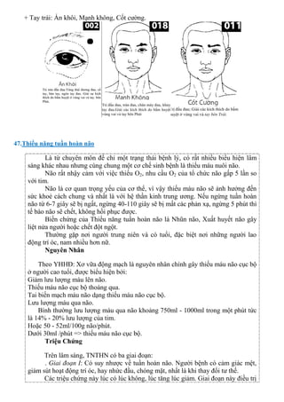 + Tay trái: Án khôi, Mạnh không, Cốt cường.
47.Thiểu năng tuần hoàn não
Là từ chuyên môn để chỉ một trạng thái bệnh lý, có rất nhiều biểu hiện lâm
sàng khác nhau nhưng cùng chung một cơ chế sinh bệnh là thiếu máu nuôi não.
Não rất nhậy cảm với việc thiếu O2, nhu cầu O2 của tổ chức não gấp 5 lần so
với tim.
Não là cơ quan trọng yếu của cơ thể, vì vậy thiếu máu não sẽ ảnh hưởng đến
sức khoẻ cách chung và nhất là với hệ thần kinh trung ương. Nếu ngừng tuần hoàn
não từ 6-7 giây sẽ bị ngất, ngừng 40-110 giây sẽ bị mất các phản xạ, ngừng 5 phút thì
tế bào não sẽ chết, không hồi phục được.
Biến chứng của Thiểu năng tuần hoàn não là Nhũn não, Xuất huyết não gây
liệt nửa người hoặc chết đột ngột.
Thường gặp nơi người trung niên và có tuổi, đặc biệt nơi những người lao
động trí óc, nam nhiều hơn nữ.
Nguyên Nhân
Theo YHHĐ: Xơ vữa động mạch là nguyên nhân chính gây thiếu máu não cục bộ
ở người cao tuổi, được biểu hiện bởi:
Giảm lưu lượng máu lên não.
Thiếu máu não cục bộ thoáng qua.
Tai biến mạch máu não dạng thiếu máu não cục bộ.
Lưu lượng máu qua não.
Bình thường lưu lượng máu qua não khoảng 750ml - 1000ml trong một phút tức
là 14% - 20% lưu lượng của tim.
Hoặc 50 - 52ml/100g não/phút.
Dưới 30ml /phút => thiếu máu não cục bộ.
Triệu Chứng
Trên lâm sàng, TNTHN có ba giai đoạn:
. Giai đoạn I: Có suy nhược về tuần hoàn não. Người bệnh có cảm giác mệt,
giảm sút hoạt động trí óc, hay nhức đầu, chóng mặt, nhất là khi thay đổi tư thế.
Các triệu chứng này lúc có lúc không, lúc tăng lúc giảm. Giai đoạn này điều trị
 