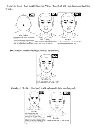 Khóa Cao thống + bấm huyệt Cốt cường, Vũ hải (thông kinh khí vùng đầu chân mày, thông
với mũi).
Day ấn huyệt Tam huyền (huyệt đặc hiệu trị viêm mũi).
Khóa huyệt Chí đắc + bấm huyệt Ấn lâm (huyệt đặc hiệu làm thông mũi).
 