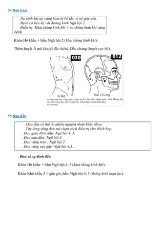 54.Đau hàm
Do kinh khí tại vùng hàm bị bế tắc, ứ trệ gây nên.
Bệnh có liên hệ với đường kinh Ngũ bội 2.
Điều trị: Khai thông kinh khí + sơ thông kinh khí vùng
bệnh.
Khóa Hổ khẩu + bấm Ngũ bội 2 (khai thông kinh khí).
Thêm huyệt Á mô (huyệt đặc hiệu), Đắc chung (huyệt cục bộ).
55.Đau đầu
Đau đầu có thể do nhiều nguyên nhân khác nhau.
Tùy từng vùng đau mà chọn cách điều trị cho thích hợp.
. Đau giữa đỉnh đầu: Ngũ bội 4, 5.
. Đau nửa đầu: Ngũ bội 4.
. Đau vùng trán : Ngũ bội 2.
. Đau vùng sau gáy: Ngũ bội 4,5…
. Đau vùng đỉnh đầu
Khóa Hổ khẩu + bấm Ngũ bội 4, 5 (khai thông kinh khí).
Khóa Khô khốc 3 + gân gót, bấm Ngũ bội 4, 5 (thông kinh hoạt lạc).
 