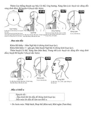 Thêm Cao thống (huyệt cục bộ), Cô thế, Ung hương, Xàng lâm (các huyệt tác động đến
vùng đỉnh đầu), Bí huyền 4 (huyệt đặc hiệu).
. Đau nửa đầu
Khóa Hổ khẩu + bấm Ngũ bội 4 (thông kinh hoạt lạc).
Khóa Khô khốc 3 + gân gót, bấm huyệt Ngũ bội 4 (thông kinh hoạt lạc).
Thêm huyệt Cô thế, Xàng lâm (bên đau), Trung nhĩ (các huyệt tác động đến vùng đỉnh
đầu), huyệt Bí huyền 3 (huyệt đặc hiệu).
. Đầu có khối u
Nguyên tắc:
. Đưa kinh khí lên đầu để thông kinh hoạt lạc.
. Dẫn máu lên đầu để làm tan khối u.
+ Do bướu máu: Nhật bách, Đoạt thế (Khư nai), Khô ngân (Tam kha).
 