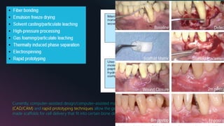 Currently, computer-assisted design/computer-assisted manufacturing
(CAD/CAM) and rapid prototyping techniques allow the generation of custom-
made scaffolds for cell delivery that fit into certain bone defects.
 