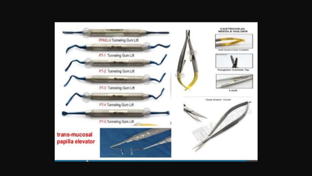 Minimally invasive periodontal surgery | PPTX | First Aid | Injuries