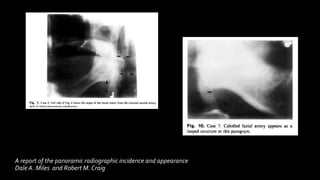 A report of the panoramic radiographic incidence and appearance
Dale A. Miles and Robert M. Craig
 
