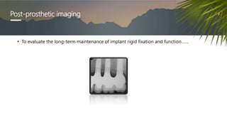 Post-prosthetic imaging
• To evaluate the long-term maintenance of implant rigid fixation and function……
 