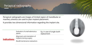 Periapical radiography
Periapical radiographs are images of limited region of mandibular or
maxillary alveolus are used to plan implant placement.
It provides two dimensional information regarding the implant site.
Indications:
Evaluation of small edentulous
spaces
Eg: in case of single tooth
replacement
Alignment and orientation of
implants during surgery
Recall/maintenance evaluations
 
