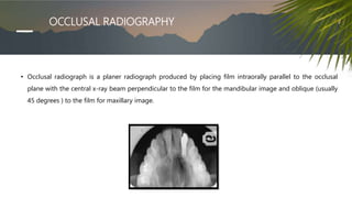 OCCLUSAL RADIOGRAPHY
• Occlusal radiograph is a planer radiograph produced by placing film intraorally parallel to the occlusal
plane with the central x-ray beam perpendicular to the film for the mandibular image and oblique (usually
45 degrees ) to the film for maxillary image.
 