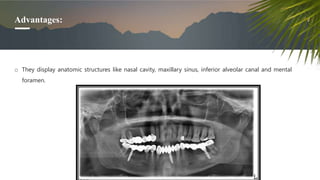 Advantages:
o They display anatomic structures like nasal cavity, maxillary sinus, inferior alveolar canal and mental
foramen.
 