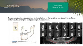 Tomography
• Tomographic units produce cross-sectional slices of the jaws that can be as thin as 1 mm
and are suitable for pre- and post-implant assessment.
TOMO- slice
GRAPH- picture
 