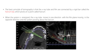 • The basic principle of tomography is that the x-ray tube and film are connected by a rigid bar called the
fulcrum bar, which pivots on a point called fulcrum.
• When the system is energized, the x-ray tube moves in one direction with the film plane moving in the
opposite direction and the system pivoting about the fulcrum
 