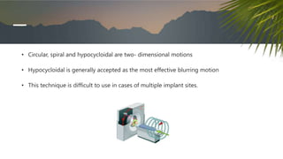 • Circular, spiral and hypocycloidal are two- dimensional motions
• Hypocycloidal is generally accepted as the most effective blurring motion
• This technique is difficult to use in cases of multiple implant sites.
 