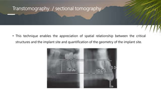 Transtomography / sectional tomography
• This technique enables the appreciation of spatial relationship between the critical
structures and the implant site and quantification of the geometry of the implant site.
 