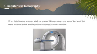 Computerised Tomography
CT is a digital imaging technique, which can generate 3D images using a very narrow “fan beam” that
rotates around the patient, acquiring one thin slice (image) with each revolution
 