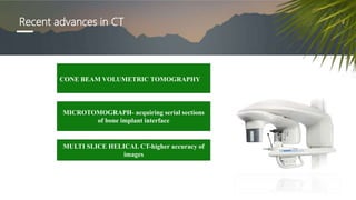 Recent advances in CT
CONE BEAM VOLUMETRIC TOMOGRAPHY
MICROTOMOGRAPH- acquiring serial sections
of bone implant interface
MULTI SLICE HELICAL CT-higher accuracy of
images
 