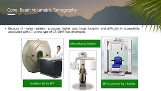 Cone Beam Volumetric Tomography
• Because of higher radiation exposure, higher cost, huge footprint and difficulty in accessibility
associated with CT, a new type of CT, CBVT was developed.
NewTom 3G by AFP
MercuRay by Hitachi
3D Accuitomo by J. Morita
 