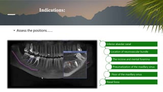 Indications:
• Assess the positions…….
Inferior alveolar canal
Location of neurovascular bundle
The incisive and mental foramina
Pneumatization of the maxillary sinus
Floor of the maxillary sinus
Nasal fossa
 