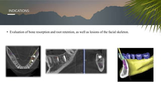 • Evaluation of bone resorption and root retention, as well as lesions of the facial skeleton.
INDICATIONS:
 