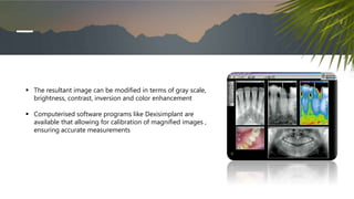  The resultant image can be modified in terms of gray scale,
brightness, contrast, inversion and color enhancement
 Computerised software programs like Dexisimplant are
available that allowing for calibration of magnified images ,
ensuring accurate measurements
 