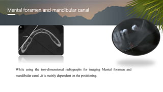 Mental foramen and mandibular canal
While using the two-dimensional radiographs for imaging Mental foramen and
mandibular canal ,it is mainly dependent on the positioning.
 