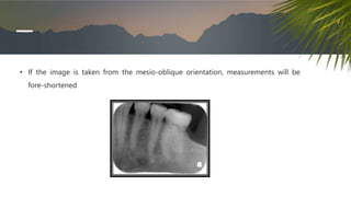 • If the image is taken from the mesio-oblique orientation, measurements will be
fore-shortened
 