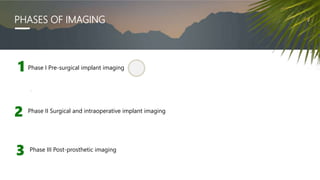 PHASES OF IMAGING
1
.
2 Phase II Surgical and intraoperative implant imaging
Phase I Pre-surgical implant imaging
Phase III Post-prosthetic imaging
 