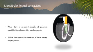 Mandibular lingual concavities
• When there is advanced atrophy of posterior
mandible, lingual concavities may be present .
• Within these concavities branches of facial artery
may be present
 