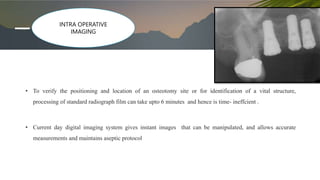 • To verify the positioning and location of an osteotomy site or for identification of a vital structure,
processing of standard radiograph film can take upto 6 minutes and hence is time- ineffcient .
• Current day digital imaging system gives instant images that can be manipulated, and allows accurate
measurements and maintains aseptic protocol
INTRA OPERATIVE
IMAGING
 