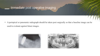 Immediate post operative imaging
• A periapical or panoramic radiograph should be taken post surgically so that a baseline image can be
used to evaluate against future images.
 
