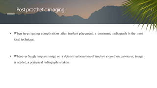 Post prosthetic imaging
• When investigating complications after implant placement, a panoramic radiograph is the most
ideal technique.
• Whenever Single implant image or a detailed information of implant viewed on panoramic image
is needed, a periapical radiograph is taken.
 
