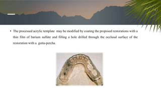 • The processed acrylic template may be modified by coating the proposed restorations with a
thin film of barium sulfate and filling a hole drilled through the occlusal surface of the
restoration with a gutta-percha.
 