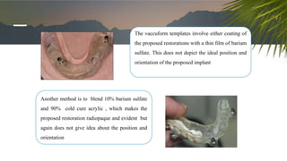 The vaccuform templates involve either coating of
the proposed restorations with a thin film of barium
sulfate. This does not depict the ideal position and
orientation of the proposed implant
Another method is to blend 10% barium sulfate
and 90% cold cure acrylic , which makes the
proposed restoration radiopaque and evident but
again does not give idea about the position and
orientation
 