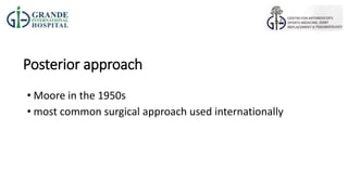 Moore Approach Tha surgical approaches and principles no video | PPTX