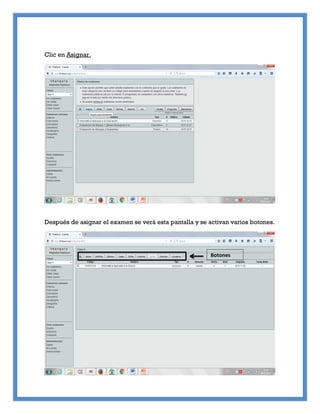 Clic en Asignar.
Después de asignar el examen se verá esta pantalla y se activan varios botones.
Botones
 