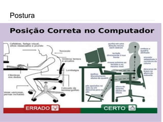Postura
 
