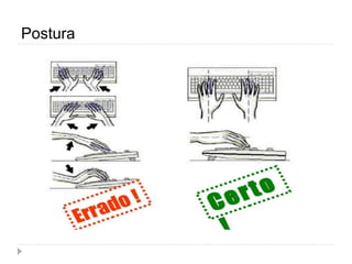 Postura
 