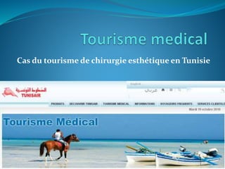Cas du tourisme de chirurgie esthétique en Tunisie
 