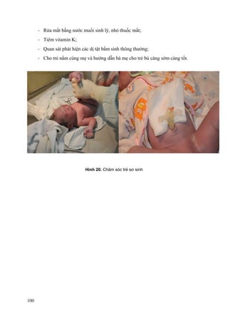 100
- Rửa mắt bằng nước muối sinh lý, nhỏ thuốc mắt;
- Tiêm vitamin K;
- Quan sát phát hiện các dị tật bẩm sinh thông thường;
- Cho trẻ nằm cùng mẹ và hướng dẫn bà mẹ cho trẻ bú càng sớm càng tốt.
Hình 20. Chăm sóc trẻ sơ sinh
 